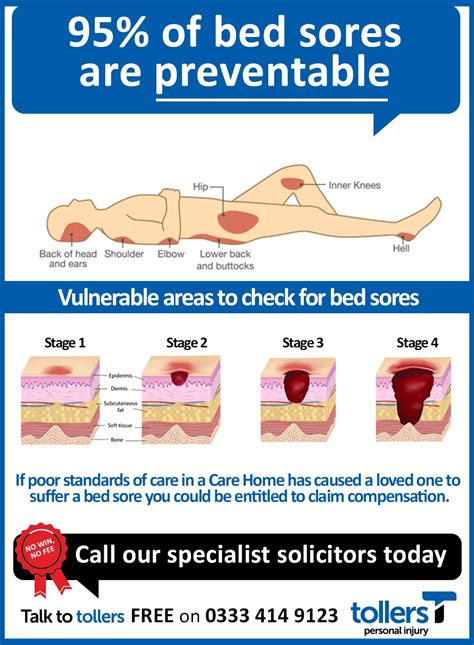 Information for patients and carers Pressure ulcers: prevention。